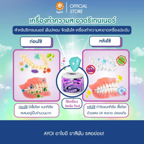 เครื่องทำความสะอาดรีเทนเนอร์