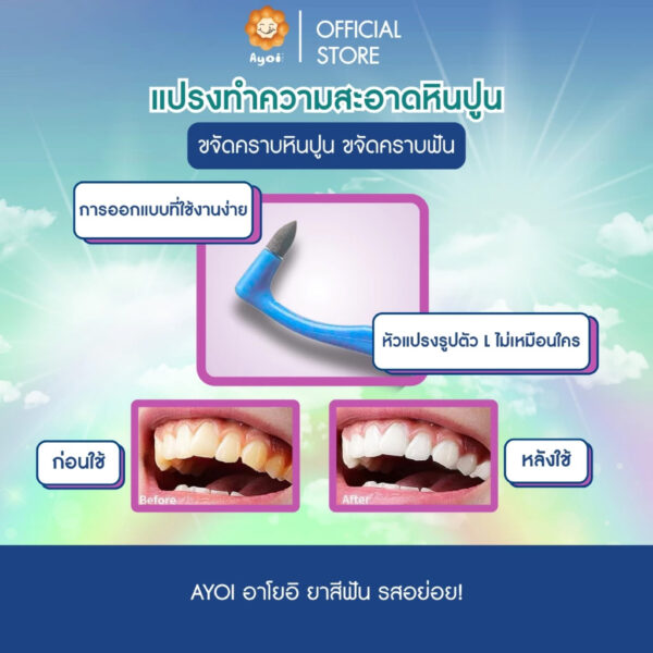 แปรง interdental 4 สี กำจัดคราบฟัน ขจัดคราบหินปูน ขจัดคราบฟัน ขจัดคราบ กาแฟ ชา คราบบุหรี่ (P07)