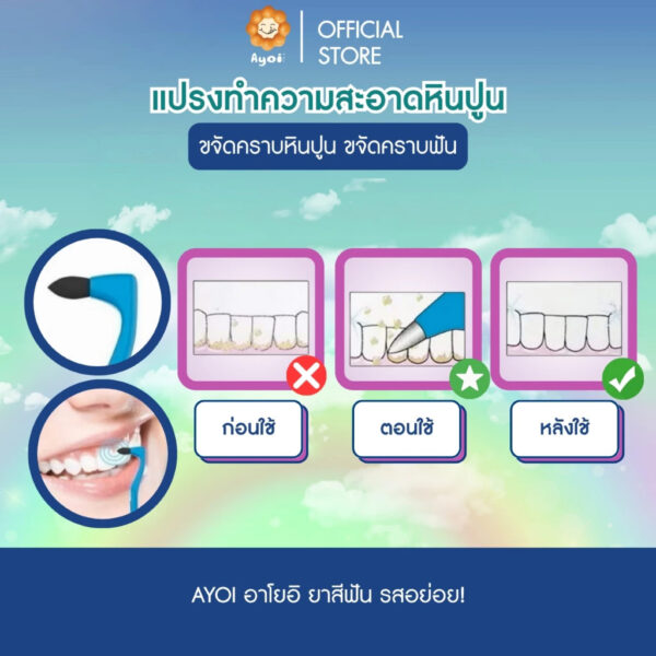 แปรง interdental 4 สี กำจัดคราบฟัน ขจัดคราบหินปูน ขจัดคราบฟัน ขจัดคราบ กาแฟ ชา คราบบุหรี่ (P07)