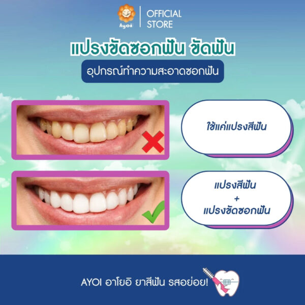 แปรงขัดซอกฟัน ขัดฟัน (P03)