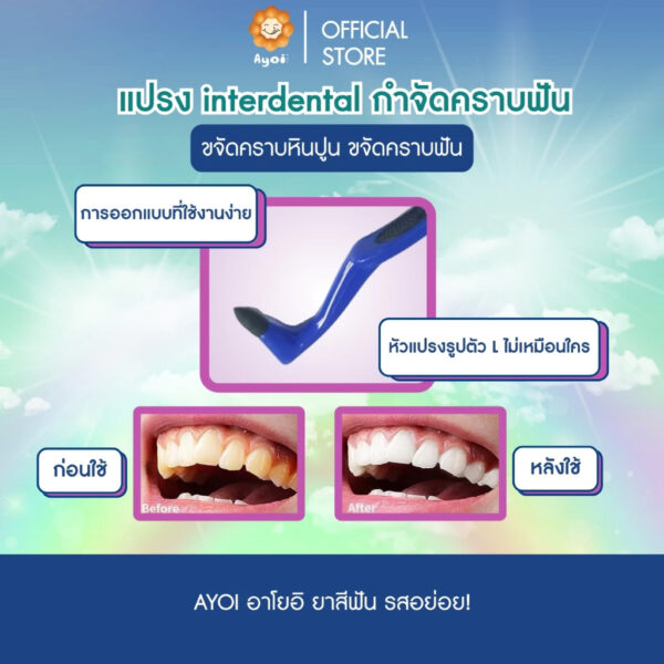 แปรง interdental กำจัดคราบฟัน ขจัดคราบหินปูน ขจัดคราบฟัน ขจัดคราบ กาแฟ ชา คราบยาสูบ (P06)