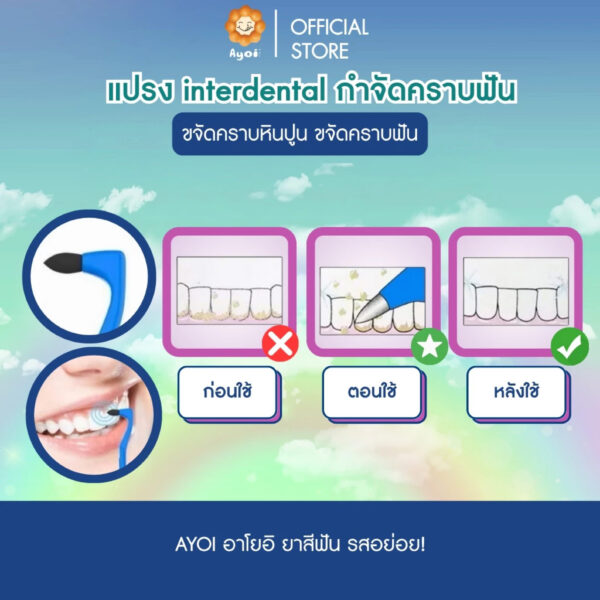 แปรง interdental กำจัดคราบฟัน ขจัดคราบหินปูน ขจัดคราบฟัน ขจัดคราบ กาแฟ ชา คราบยาสูบ (P06)
