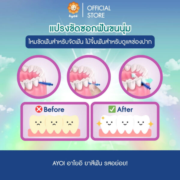 แปรงขัดซอกฟันขนนุ่ม ไม้จิ้มฟันสำหรับดูแลช่องปาก ใช้ได้ทั้งจัดฟันหรือไม่จัดฟันและฟันปลอม 40ชิ้น/กล่อง (A18)